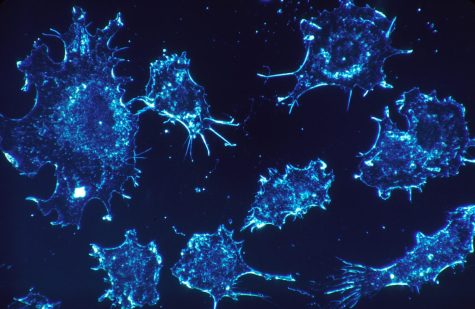 Minnesota Researchers Make Breakthrough Discovery in Cancer Treatment: Potential New Treatment Methods for Patients